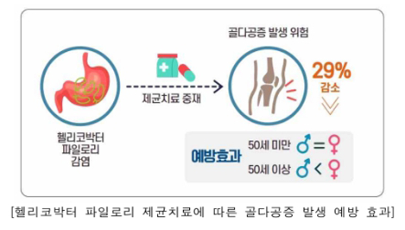 헬리코박터 제균 치료, 골다공증 예방 효과 확인